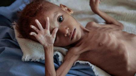 骨瘦如柴的搞笑图片,搞笑图片带你领略幽默魅力